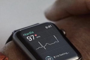 美国贸易法庭裁定苹果侵权 Apple Watch可能被禁止进口至美国